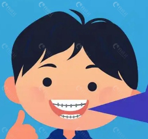成都儿童牙齿矫正价格