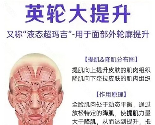 什么是英伦大提升？