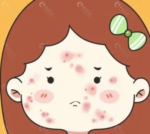 脸上坑坑洼洼的痘坑成因与类型