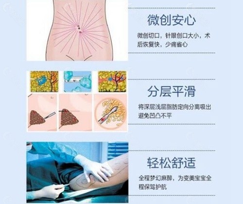 汕头名流医疗美容门诊部吸脂优势介绍