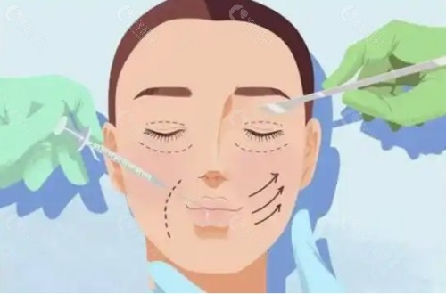 大连做双眼皮修复好的医生有哪些？