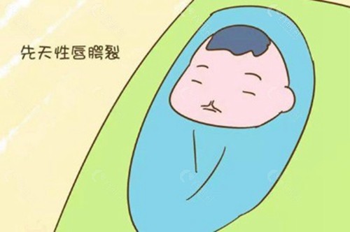 嫣然天使基金唇裂修复申请流程