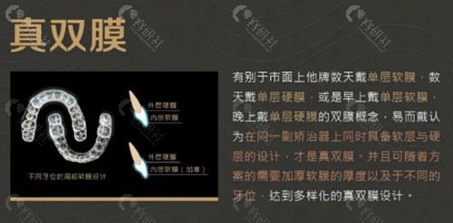 易而戴隐形牙套好用吗？