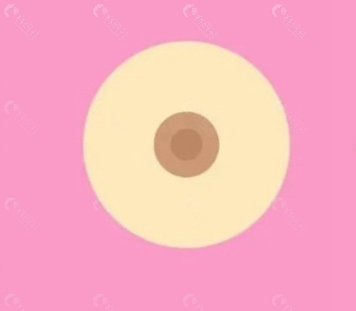 乳晕漂红会不会留疤？