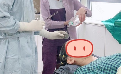扁头变圆头真人实例