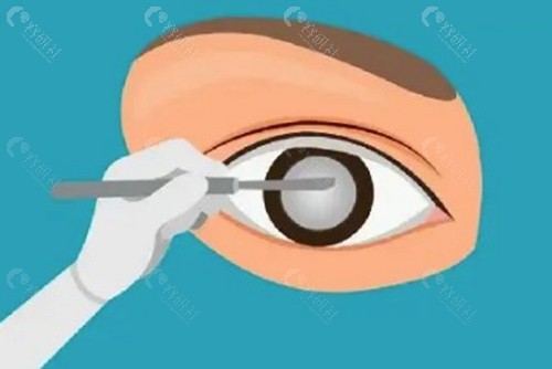 三明华厦眼科医院和东南眼科哪个好？
