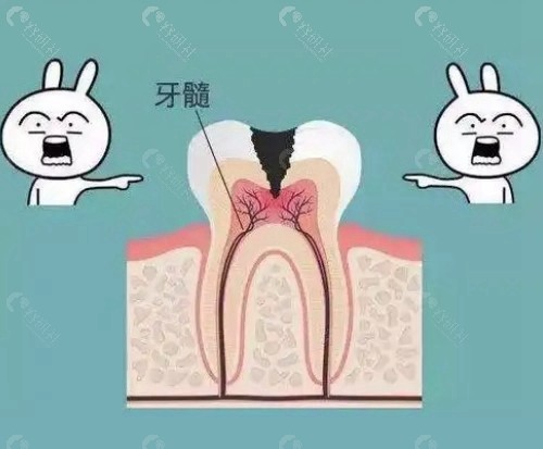 周口正规医院根管治疗收费标准
