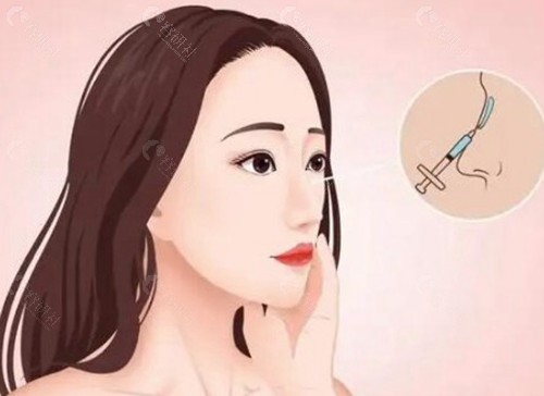 广州爱贝芙隆鼻好的医生及坐诊医院一览