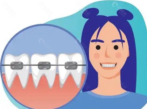 埋伏牙牵引正畸牵引痛苦吗？