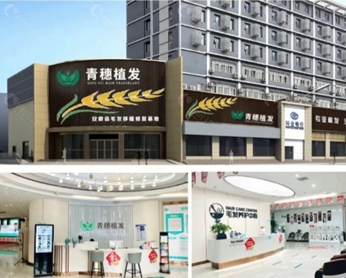 青穗植发医院怎么样
