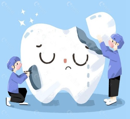 补牙后是否需要做牙套呢