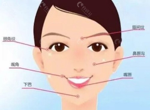 inmode和钛提升哪个好？