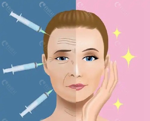 脸上打轻薄针和溶脂针一样吗？