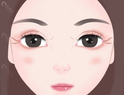 吕方中医生眼部整形怎么样