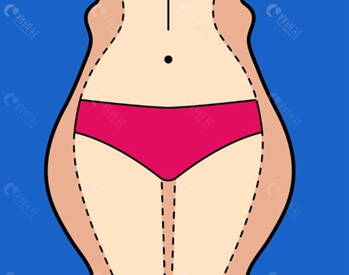 大腿抽脂1000ml能细多少？