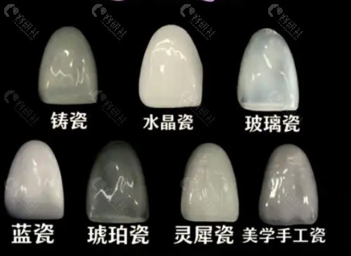 义获嘉E-max怎么样？