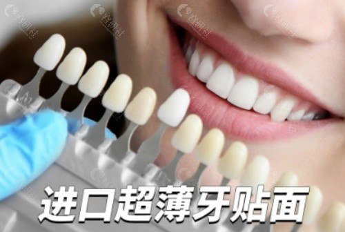美国3M拉瓦瓷贴面好不好？