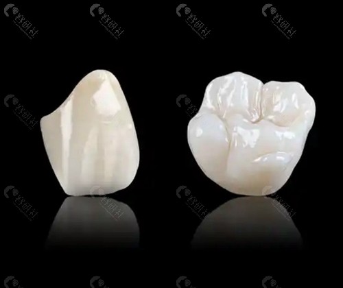 现在做全瓷牙一颗价格是多少？