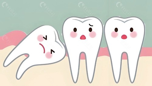 黄南州牙科诊所拔智齿价格