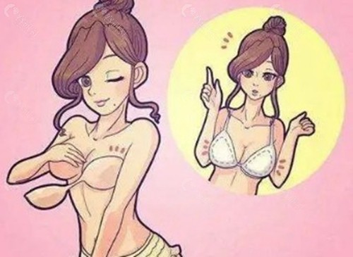 法芮娅假体隆胸三种系列怎么选择？