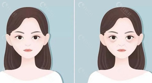 深圳眼周年轻化好价格一览