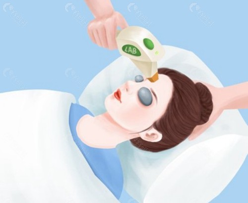 去红血丝是激光好还是光子好？