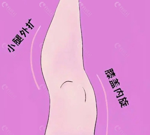 成都直腿成型术哪家医院可以做？