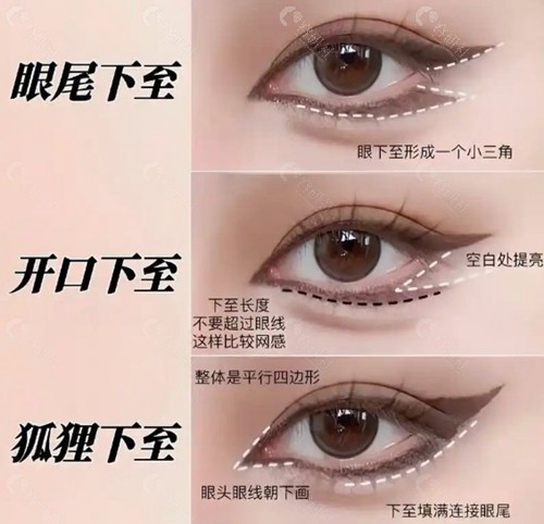 眼睑下至手术有风险吗？