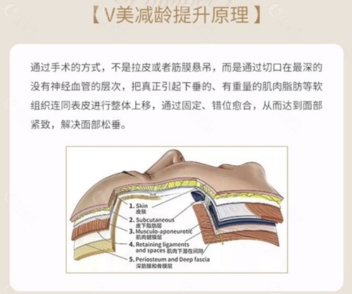 北京微拉美面部提升术哪家好？