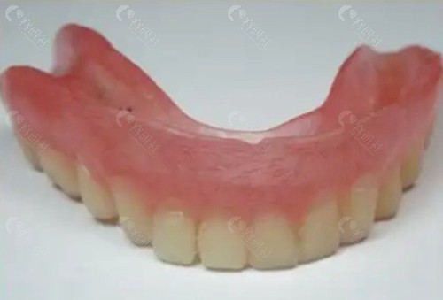 仿生牙和活动假牙怎么选？