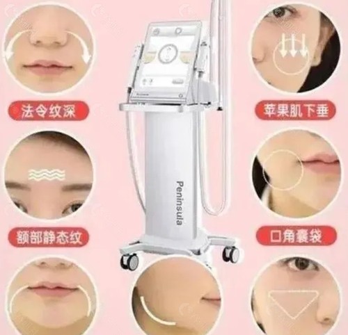 钻石超声炮好吗