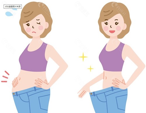 腹直肌分离是否能自行恢复？