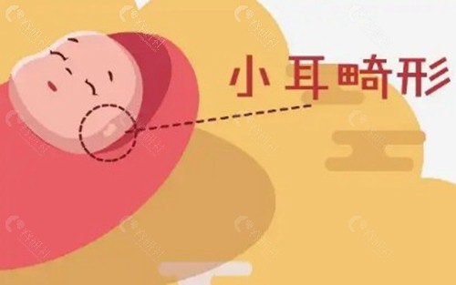 安波和郭志华小耳再造哪个技术更好？