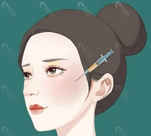 面部脂肪复位提升术是什么？