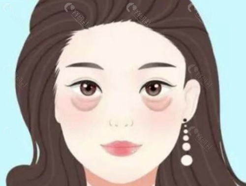 下眼袋去皮过多导致眼睛闭不上怎么修复？
