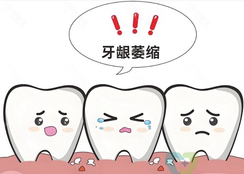 做牙齿贴面真的可以保护牙龈萎缩吗？