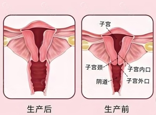 私密鳄鱼术是什么手术？