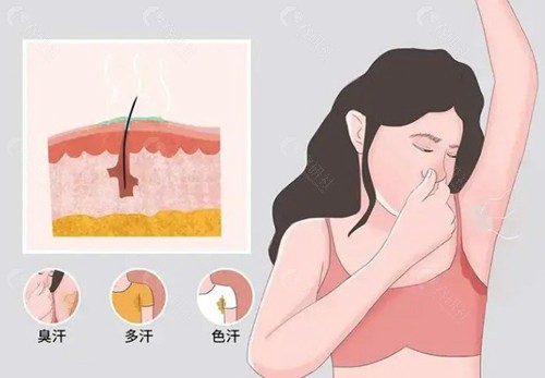 40岁腋窝突然有臭味了正常吗？