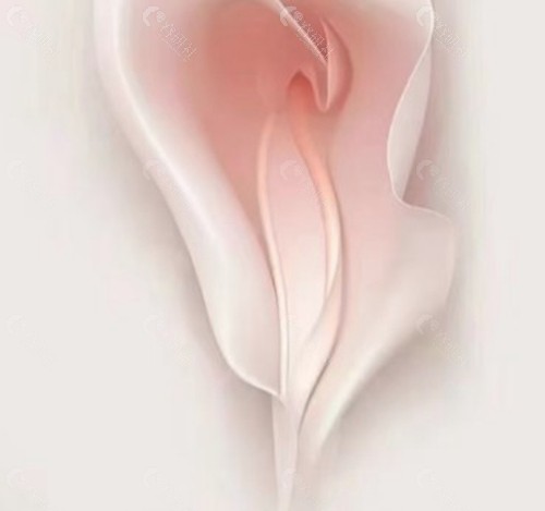 哺乳期可以做私密激光手术吗？