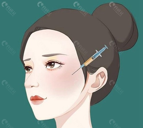 面部填充后脸显假体是怎么回事
