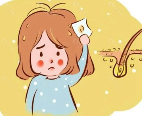  头皮营养针治疗脱发有用吗