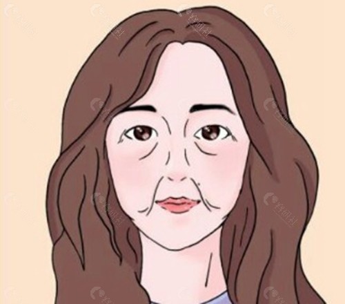 影响微拉美面部提升价格的因素
