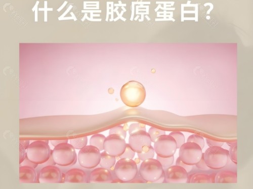 胶原蛋白注射隆鼻好不好？