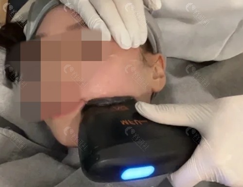 美拉美超声刀和超声炮热玛吉区别