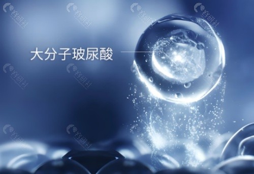 玻尿酸打直角肩好不好？