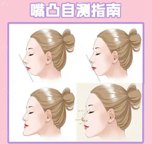 治疗过程中的注意事项