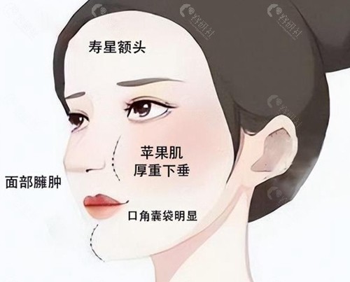 北京馒化修复口碑好的医生排名前十