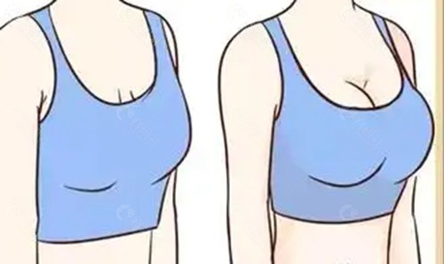 摩尔丰胸好吗
