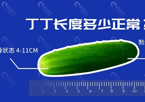 玻尿酸增粗能维持多久