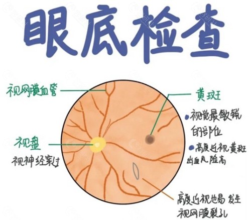 扫描激光眼底检查的主要功能